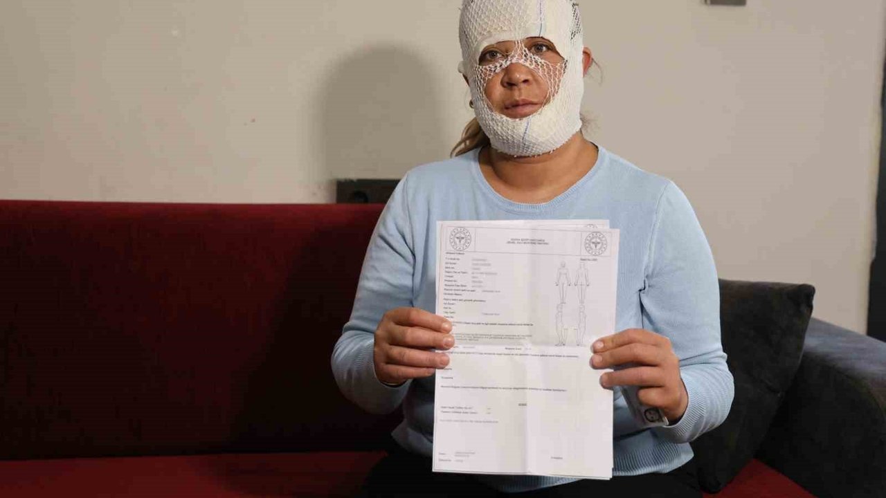 Güzelleşmek uğruna gittiği merkezde yüzü yandı