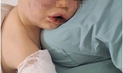 Darp sonucu hastanelik olan bebek devlet korumasına alınacak