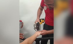 Tarsus'ta Makasa Sıkışan Parmağı İtfaiye Kurtardı