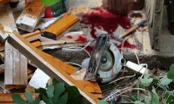 Yaşlı adam bacağını elektrikli testereye kaptırdı