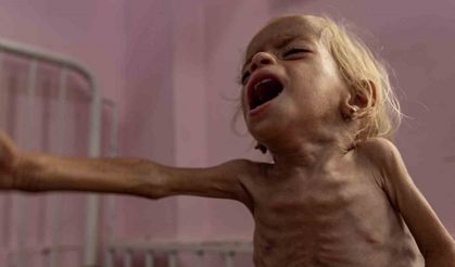 Gazze’de 3 Filistinli daha açlık nedeniyle hayatını kaybetti