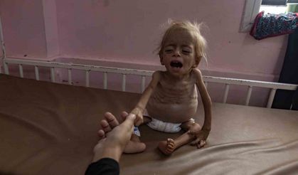 Gazze’de 8 sivil daha açlık nedeniyle hayatını kaybetti