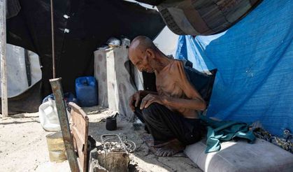 Gazze’de açlık nedeniyle 2’si çocuk 5 sivil daha hayatını kaybetti