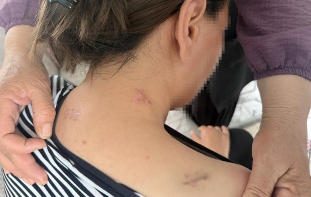 17 Kez Bıçaklanan Kadın Ölü Numarası Yaparak Kurtuldu!