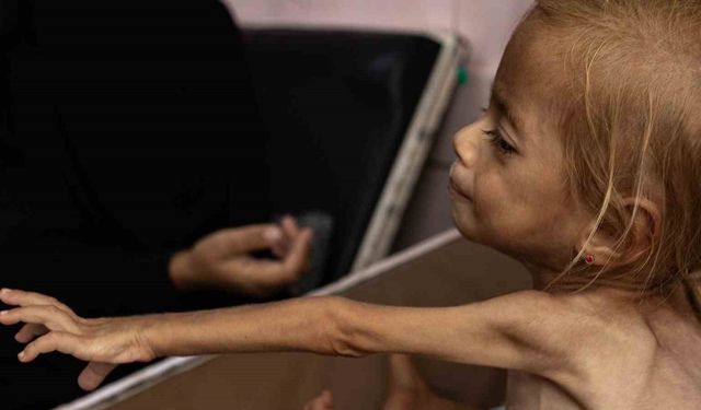 Gazze’de 24 saat içinde 5 sivil açlık nedeniyle hayatını kaybetti