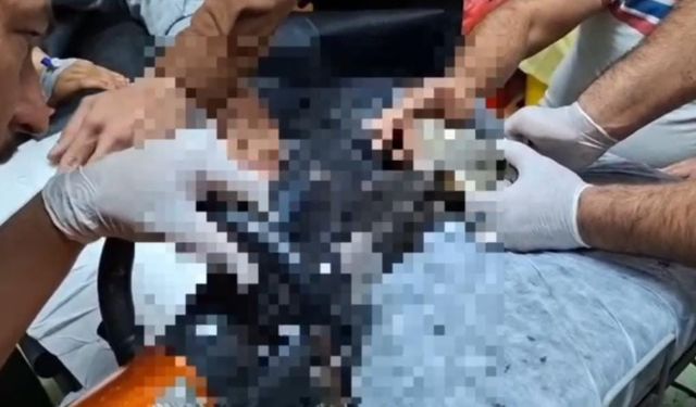 Tel Abyad’ta elini kıyma makinesine kaptıran çocuk Şanlıurfa’da tedavi altına alındı