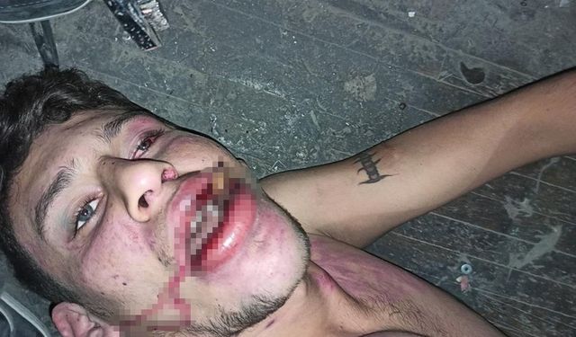 Antalya'daki Korkunç İşkence Davasında Karar Çıktı!