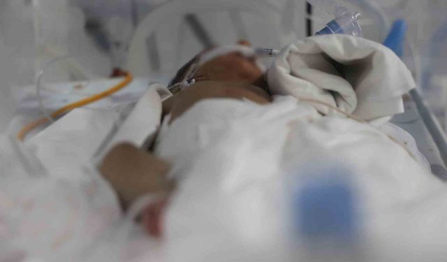 Bin 300 gramlık bebeğe başarılı ameliyat