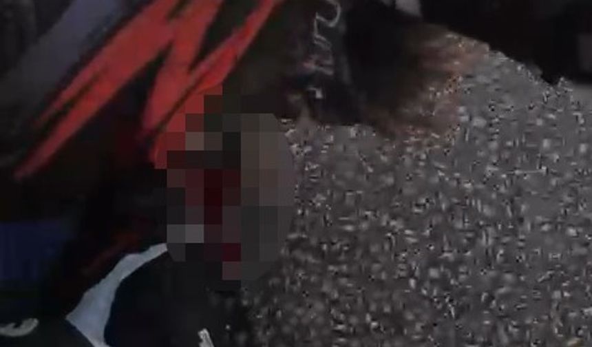 Motosikletiyle bariyere çarpmıştı, hayata 25 gün tutunabildi