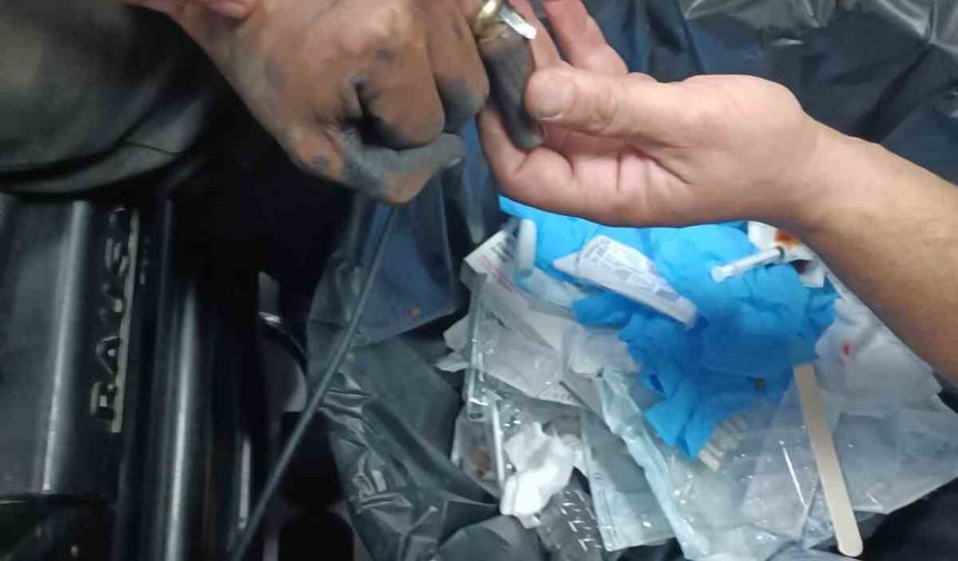 Parmakta sıkışan yüzük, hastanede doktor ve itfaiye ekibi tarafından çıkartıldı