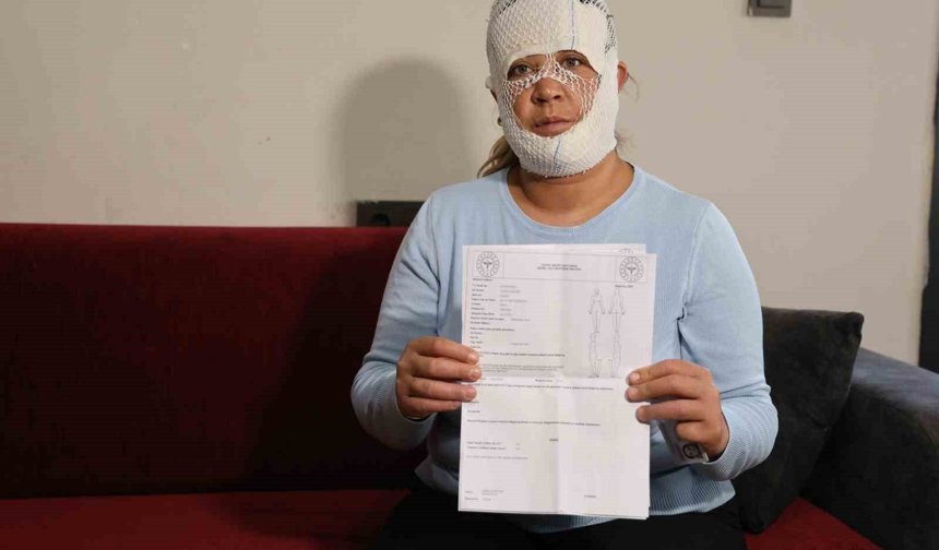 Güzelleşmek uğruna gittiği merkezde yüzü yandı