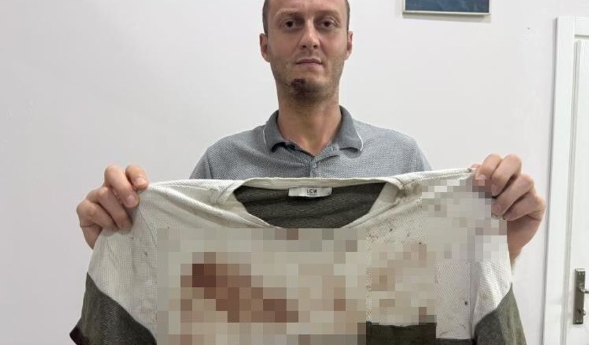 Gürültü tartışması sopalı kavgayla bitti: O anlar kamerada