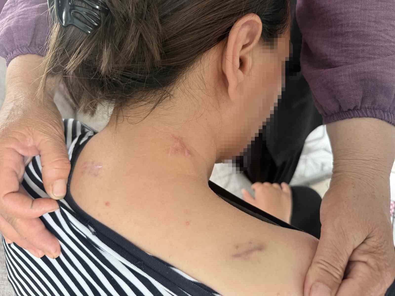 17 Kez Bıçaklanan Kadın Ölü Numarası Yaparak Kurtuldu!