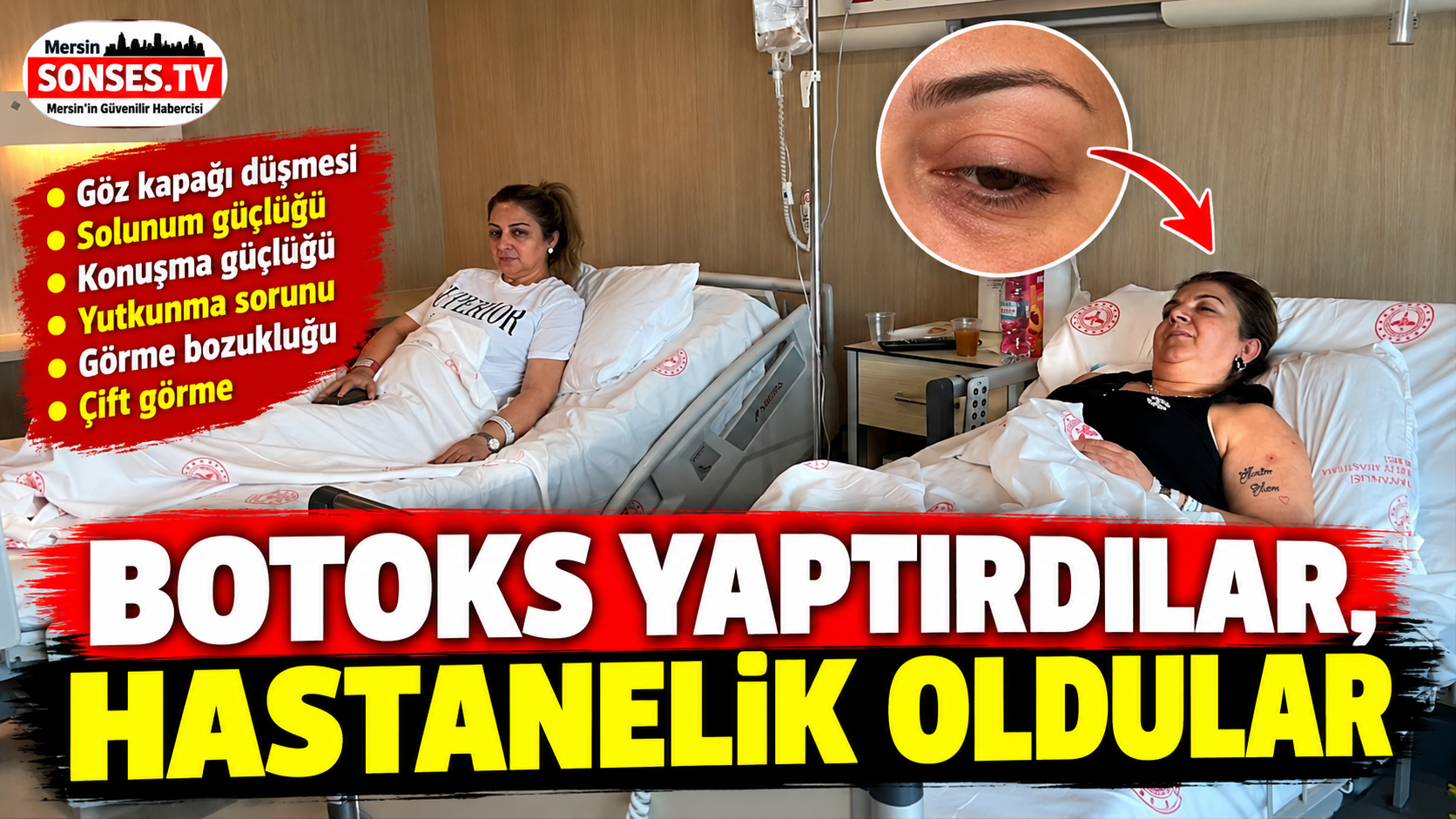 Mersin'de Botoks sonrası 3 kadın hastanelik oldu